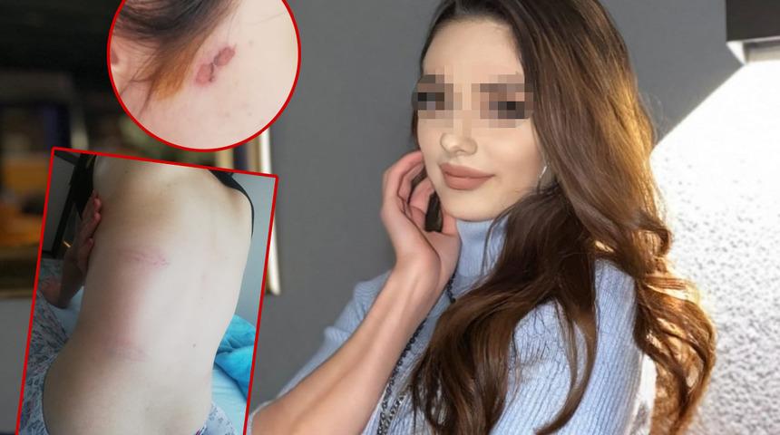 Konya'da rezidanstaki işkence olayında yeni gelişme! Genç kadına dehşeti yaşatmışlardı