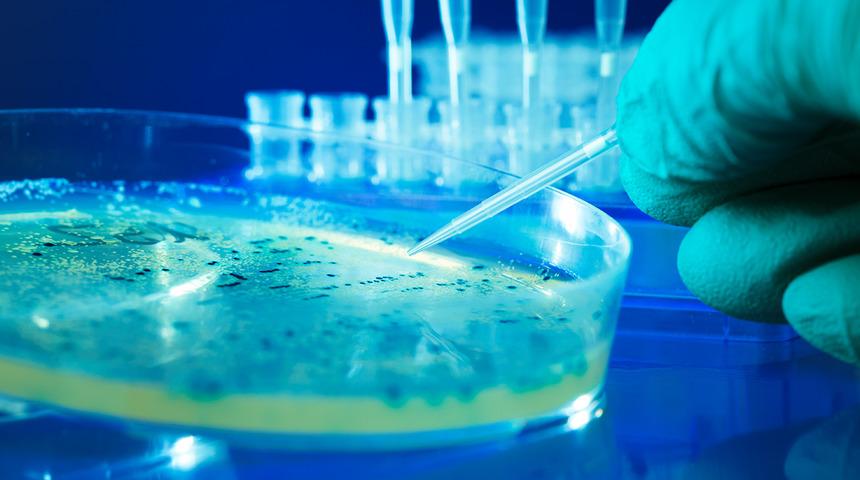 Dünyada Salmonella alarmı! DSÖ'den açıklama geldi: 11 ülkede 151 kişide görüldü