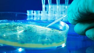 Dünyada Salmonella alarmı! DSÖ'den açıklama geldi: 11 ülkede 151 kişide görüldü