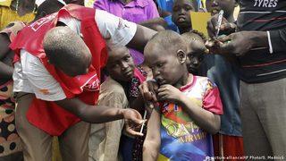 Kızamık vakalarında yüzde 80'lik artış