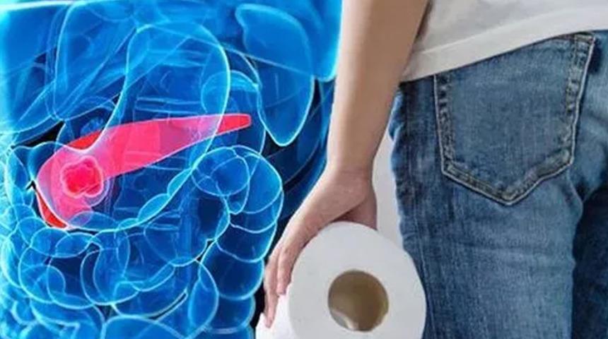 Bu belirtilerden biri bile varsa hastaneye koşun! Pankreas kanseri belirtileri nelerdir?