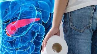 Bu belirtilerden biri bile varsa hastaneye koşun! Pankreas kanseri belirtileri nelerdir?