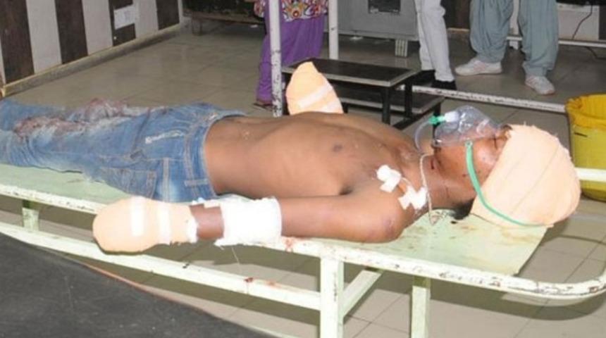 8 aylık bebeğine tecav&uuml;z eden gencin ellerini kesti