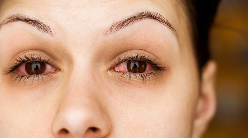 Ciddi hasar bırakıyor: Körlüğe neden olabilir!