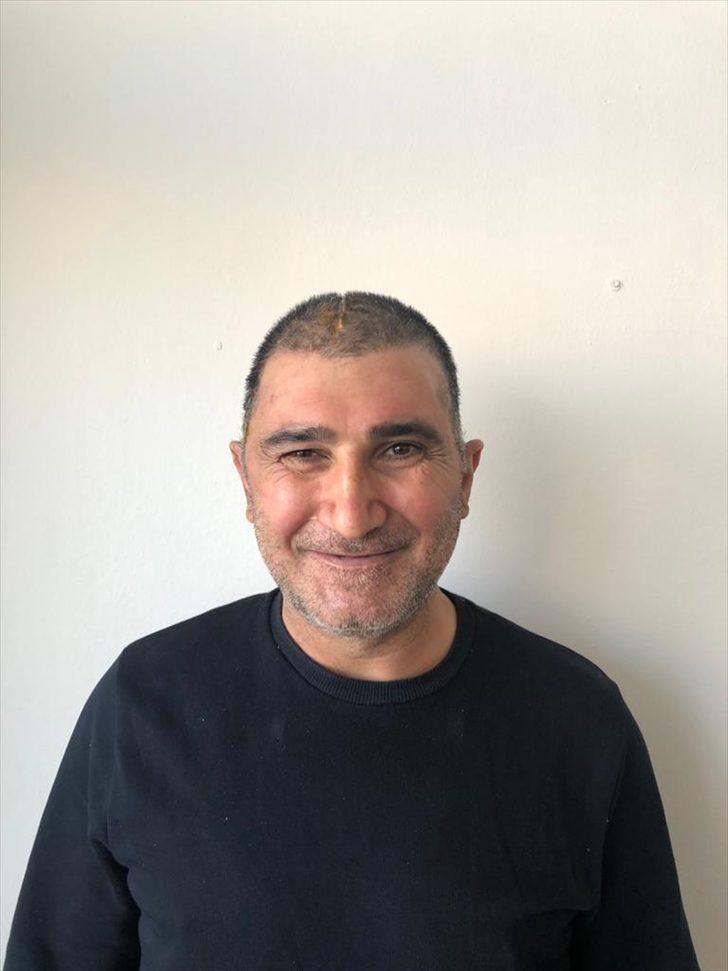 Kafatasının yüzde 83'ü parçalanan hasta, titanyum parçalarıyla eski görüntüsüne kavuştu G2