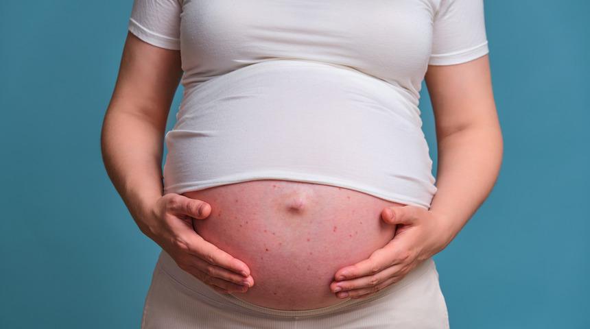 Hamilelik döneminde artmaya başlıyor! Cilt lekelerinde dikkat edilmesi gerekenler