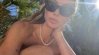 Şeyma Subaşı bikini altını sıyırıp güneş yanığını gösterdi