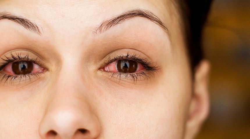 Fark edilmeden çok sık yapılıyor! Göz hastalıklarına neden oluyor 