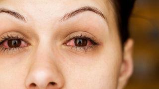 Fark edilmeden çok sık yapılıyor! Göz hastalıklarına neden oluyor 