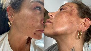 Eğlence mekanında karşılaşınca dehşeti yaşatmıştı! Dayakçı eski sevgiliye 16 yıl hapis istemi