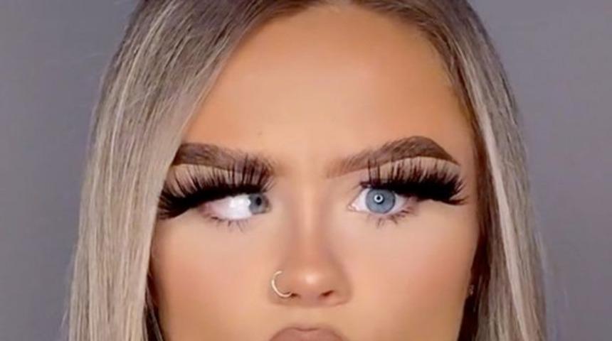 Sol gözü sayesinde TikTok’ta fenomen oldu! “Tek pişmanlığım gözlük takmamak”