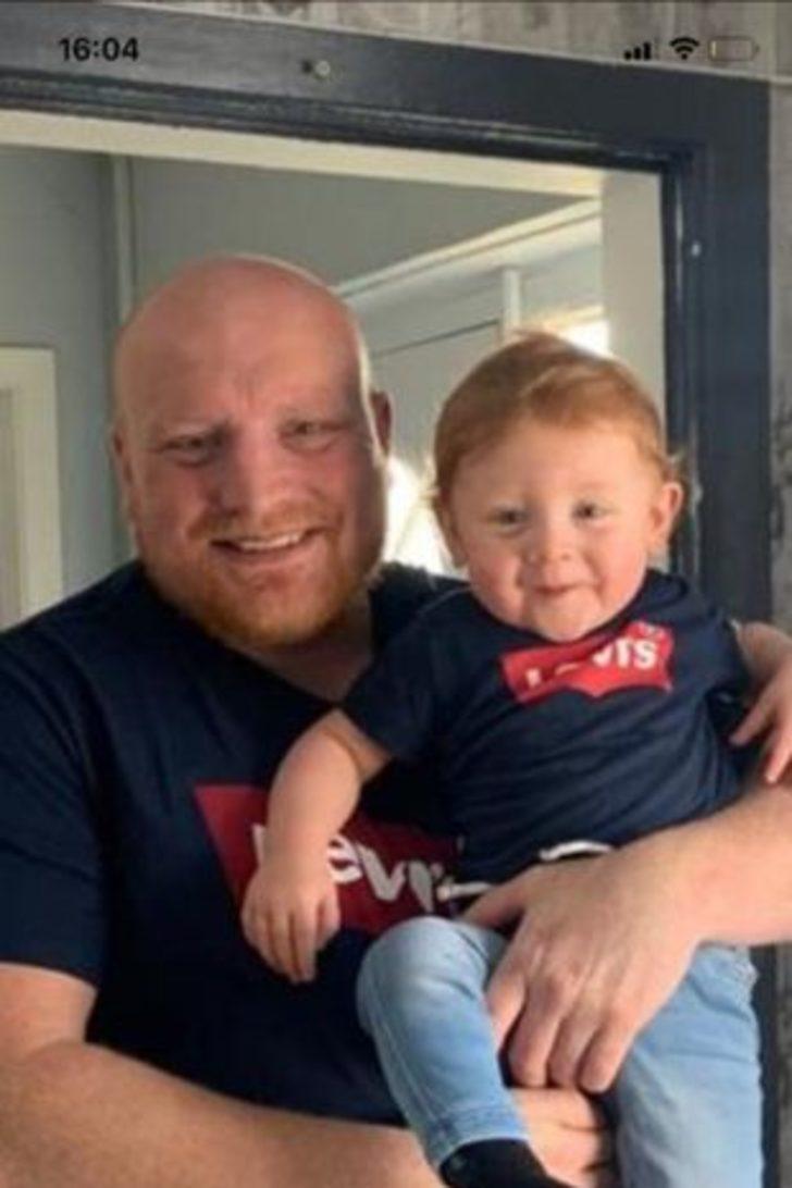 Küçük bir lekeyle başladı! Annesi basit bir döküntü zannetti, dakikalar içinde tüm vücudunu sardı G4