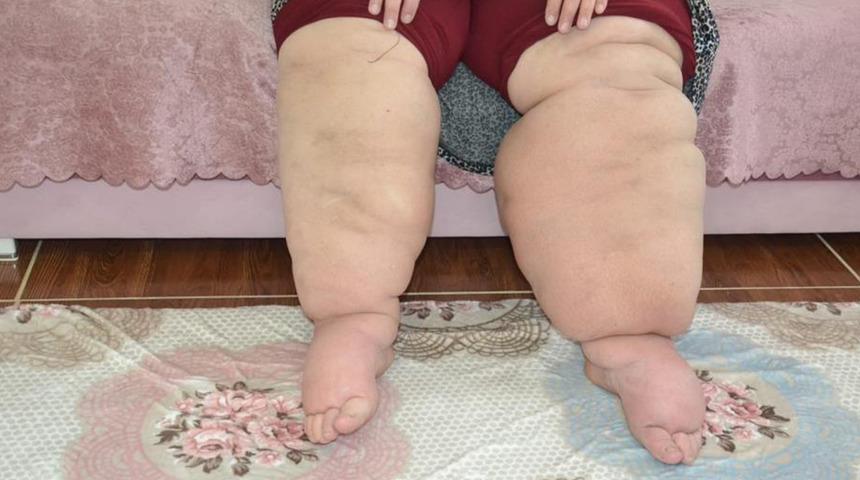 Hayatı kabusa döndü! Doktorlar teşhis koyamadı, günden güne büyüyor