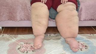 Hayatı kabusa döndü! Doktorlar teşhis koyamadı, günden güne büyüyor