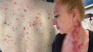 Herkesi açık açık uyardı: Asit saldırısı kurbanı gibiyim