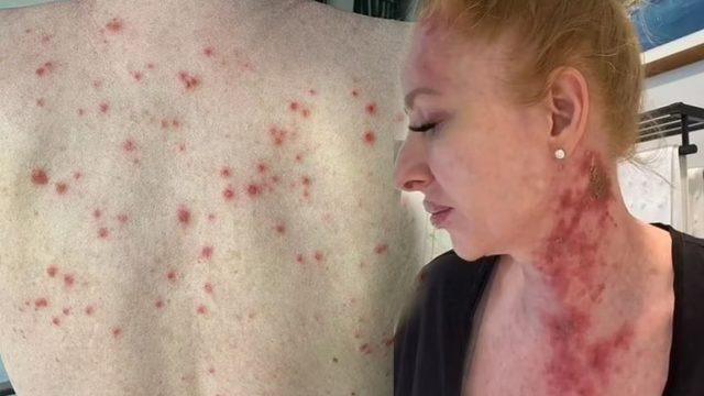 Herkesi açık açık uyardı: Asit saldırısı kurbanı gibiyim