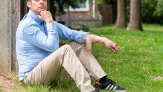 Penisi yıllardır kolunda olan adam, operasyonundan sonra flört uygulamasına katıldığını söyledi! “Aşka hazırım”