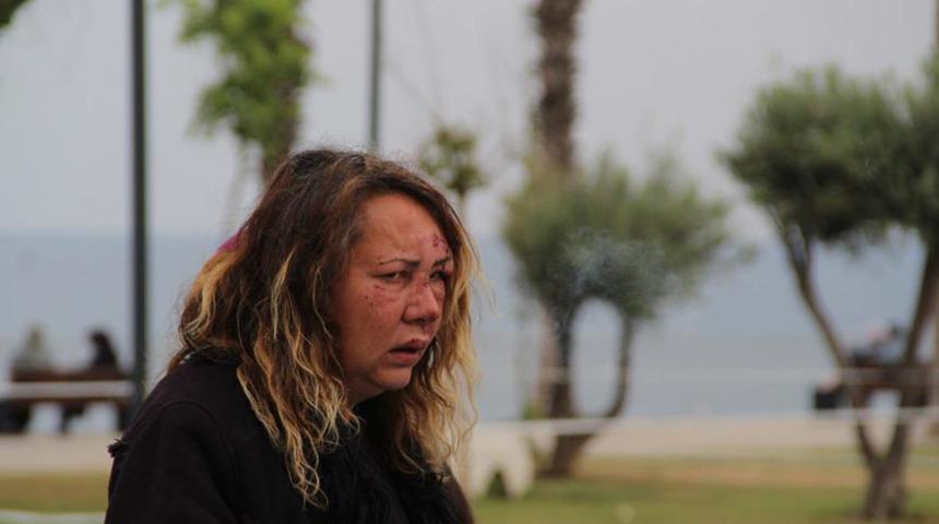 Antalya'da Rus kadına saldırı! Sahilde darp edildi