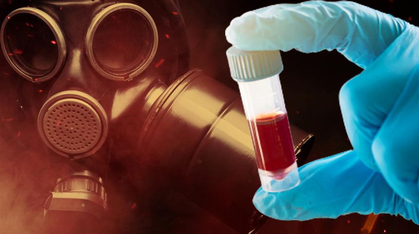 Rusya'dan Ukrayna'ya 'Biyolojik silahlar için poligon' benzetmesi! Çok çarpıcı 'kan örneği' detayı...