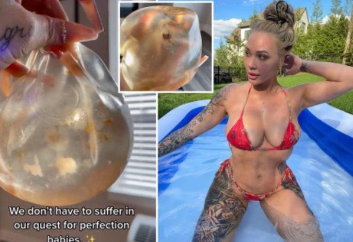 Göğsünden çıkan şoke etti! Videosunu milyonlar izledi