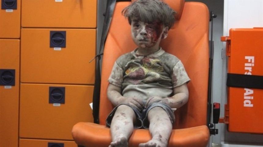 Ümran Bebek öldü mü? Savaşın dehşetini göstermişti