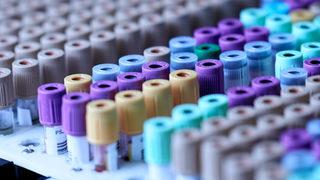 Yeni salgın endişesi: Avrupa'da gizemli hepatit can aldı!