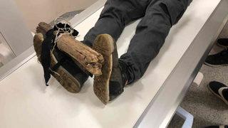 Ayağına batan çivili tahta ile hastaneye gitti!