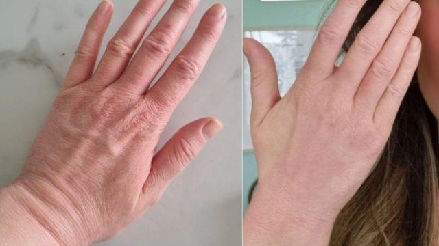 Bu ellerin sahibini gören gözlerine inanamıyor!