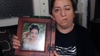 Hayatı kabusa döndü! Ameliyat sonrası yüz felci geçirdi, kafatasının bir kısmını kaybetti