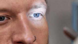 Belirti vermeden ilerliyor! Körlüğe neden oluyor