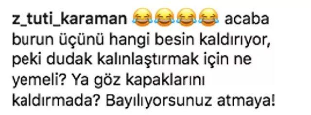 Üç Kuruş'un Bahar'ı Nesrin Cavadzade alay konusu olmuştu! Meğer 'estetik' iddialarını yalanlayan ünlü oyuncunun bu halinden eser yokmuş: Onu hiç böyle görmediniz!