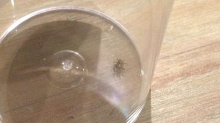 Gen&ccedil; şarkıcı bir hafta kulağında &ouml;r&uuml;mcekle yaşamış