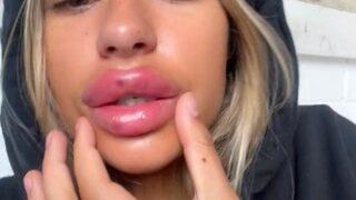 Rus dudak estetiğinden pişman oldu! “Dudaklarım o kadar büyük ki...”