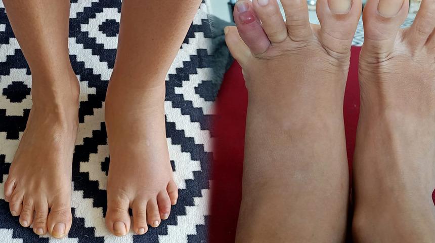 Ayağında acı hissetti, denizden koşarak çıktı! 'Neredeyse bayılacaktım'