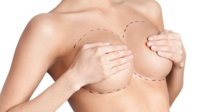 Meme implantları: Kas altına mı yoksa üstüne mi yerleşecek?