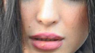 Silikonda Uçuk Olur mu?