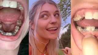 23 yaşında tüm dişleri döküldü! Yaptığı en büyük hatayı hepimiz yapıyoruz