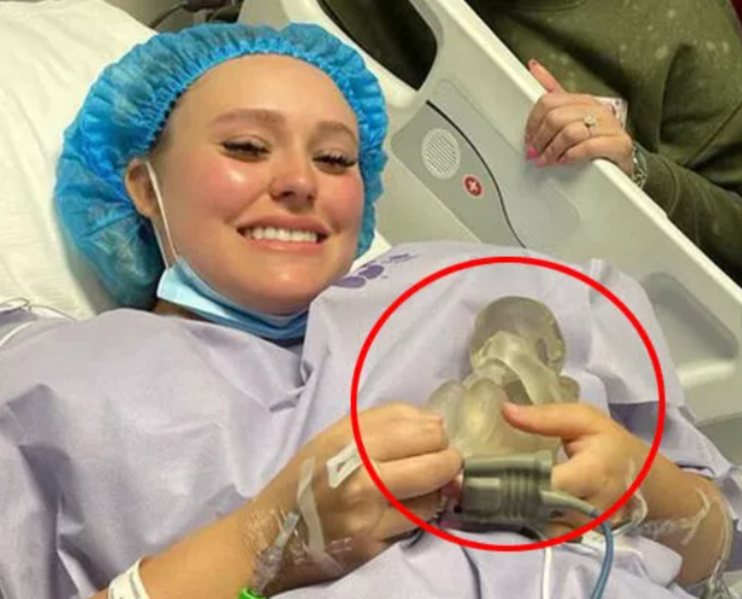 Tıp d&uuml;nyasına ge&ccedil;ti! Bebeğini ikinci kez doğuracak: Duyduğumda inanmadım