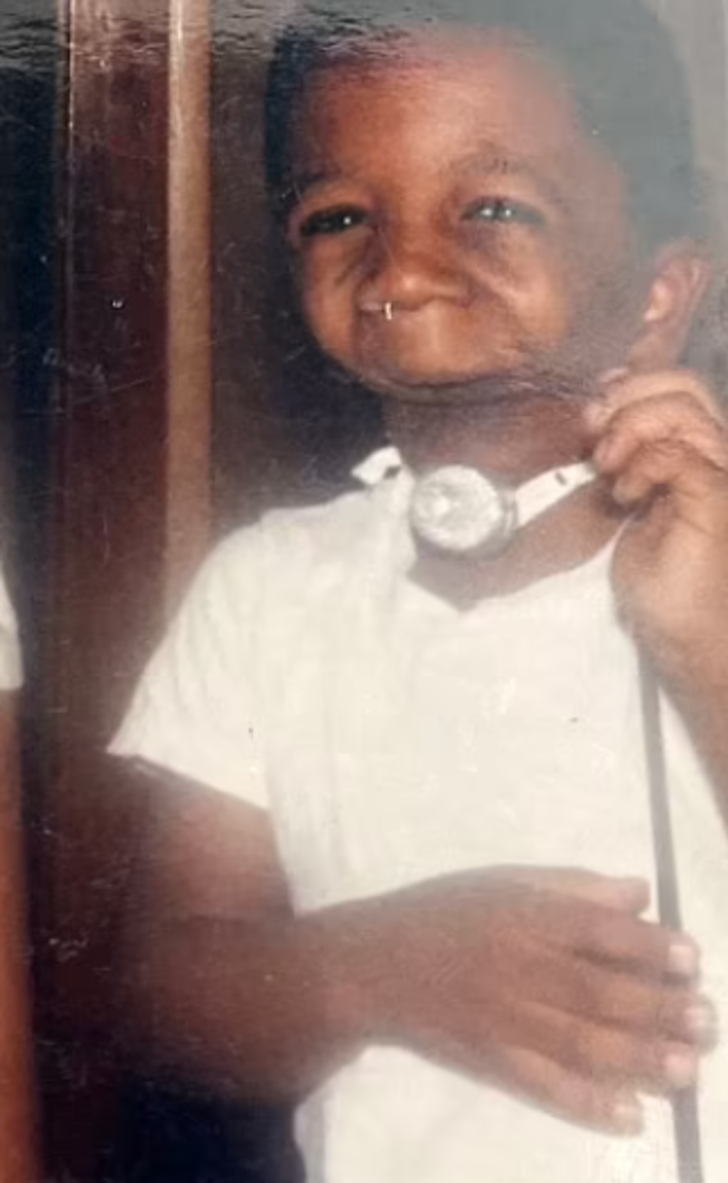 Annesi gördüğünde şoke olmuştu! Çenesiz doğan adam aradığı aşkı buldu: Evlenmemi asla beklemiyorlardı G1