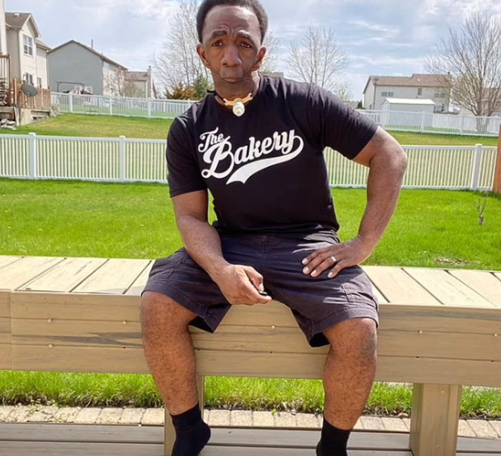 Annesi gördüğünde şoke olmuştu! Çenesiz doğan adam aradığı aşkı buldu: Evlenmemi asla beklemiyorlardı G4