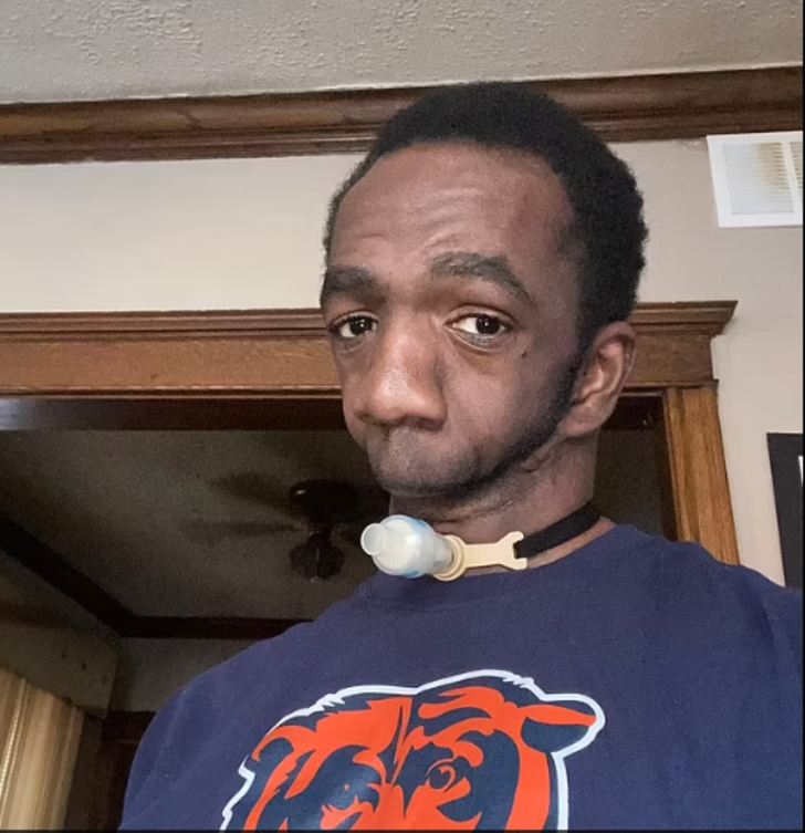 Annesi gördüğünde şoke olmuştu! Çenesiz doğan adam aradığı aşkı buldu: Evlenmemi asla beklemiyorlardı G5