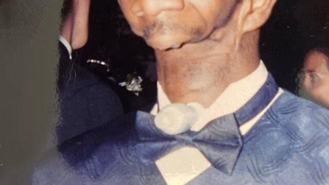 Annesi gördüğünde şoke olmuştu! Çenesiz doğan adam aradığı aşkı buldu: Evlenmemi asla beklemiyorlardı