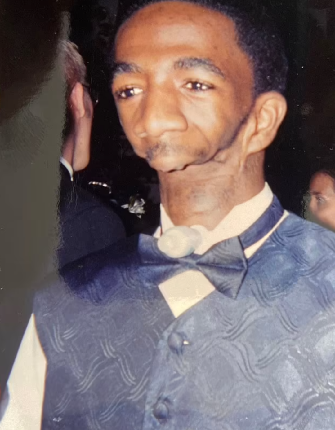 Annesi g&ouml;rd&uuml;ğ&uuml;nde şoke olmuştu! &Ccedil;enesiz doğan adam aradığı aşkı buldu: Evlenmemi asla beklemiyorlardı