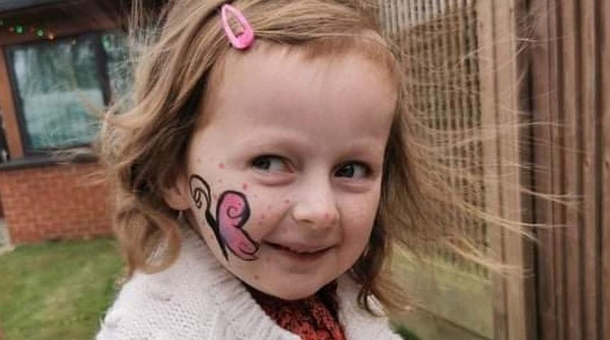 Aman dokunmayın! En ufak temas onu bir heykele dönüştürüp vücudunu kilitliyor