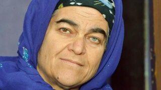 Gözlerinden biri mavi, diğeri kahverengi