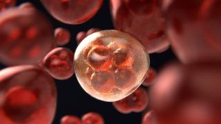 Kritik yaş 45! Profesör o hastalığa karşı uyardı 'En çok bu gıdalar sebep oluyor'