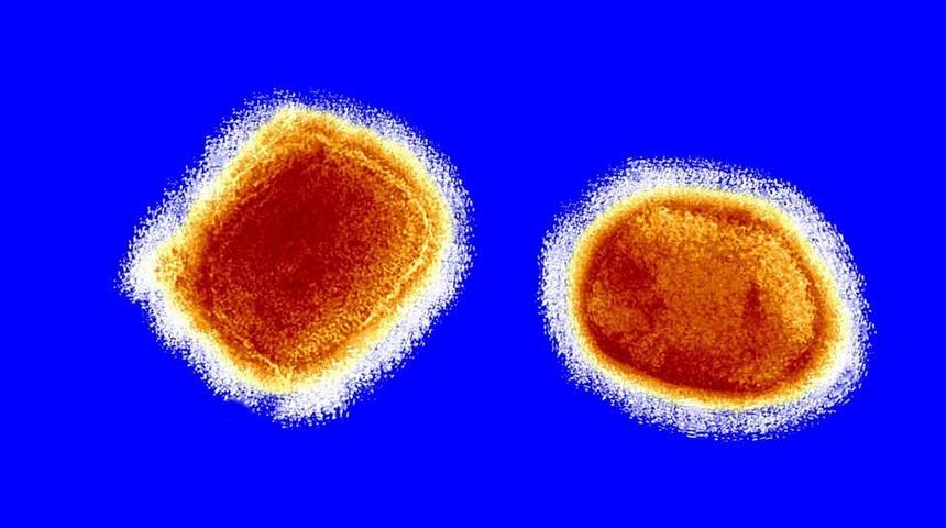 Maymun &ccedil;i&ccedil;eği vir&uuml;s&uuml;nde son durum! Karantina kararları peş peşe alındı, 'cinsel ilişki' uyarısı geldi