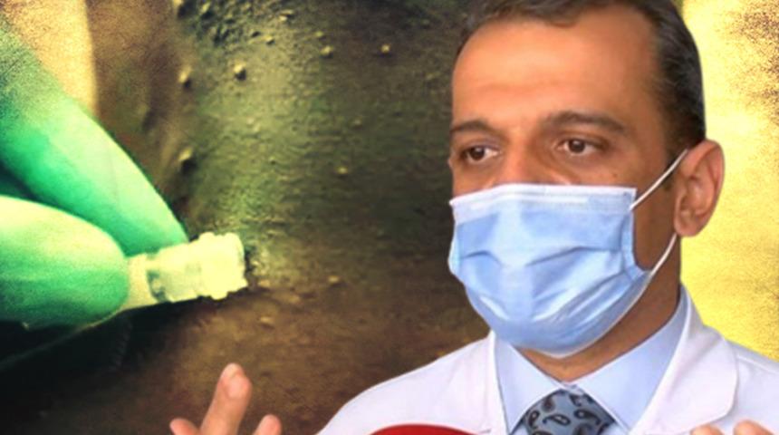 SON DAKİKA | Maymun çiçeği virüsü alarmı! 'Hastalık pandemiye dönüşebilir, kötü bir rüya' diyerek uyardı