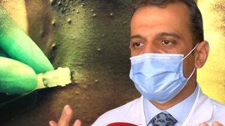 SON DAKİKA | Maymun çiçeği virüsü alarmı! 'Hastalık pandemiye dönüşebilir, kötü bir rüya' diyerek uyardı