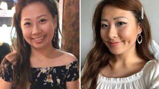 Ameliyattan sonra hayatını şokunu yaşadı! Konuşuyor ama kimse onu anlamıyor